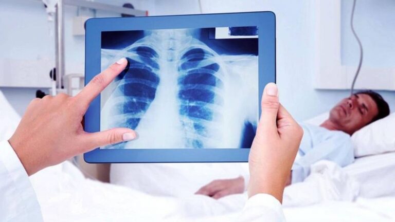 Tuberculosis: una enfermedad «antigua» que no se fue y recobra fuerza